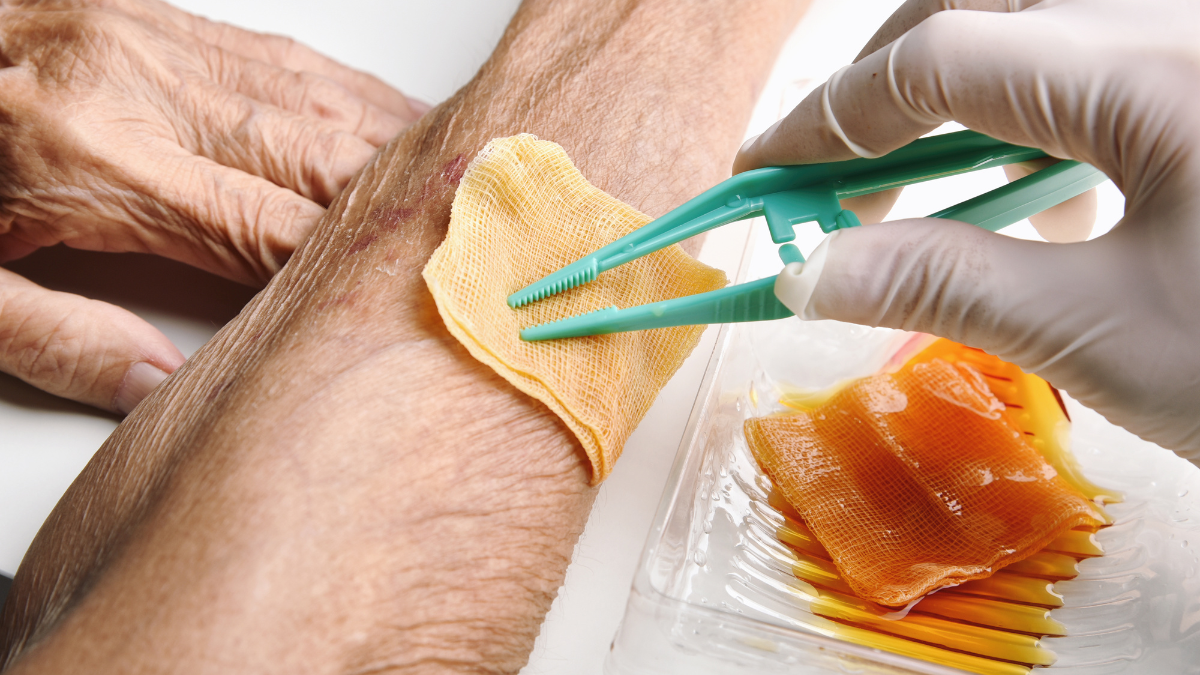 infection of wound due to methicillin resistant staphylococcus aureus icd 10